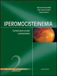 Iperomocisteinemia. Complicanze oculari e prevenzione Esclusivo