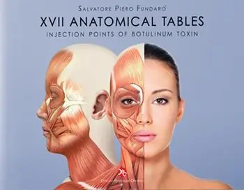 Offerta Limitata 17 anatomical tables. Injection points of Botulinum toxin