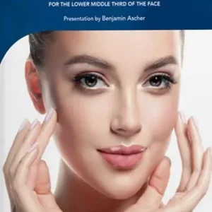 Bestseller Fillers. LP injection modes for the lower middle third of the face